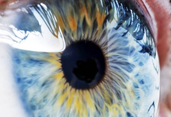 A close up of an eye

Description automatically generated