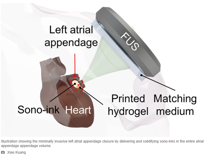 A diagram of a human heart

Description automatically generated