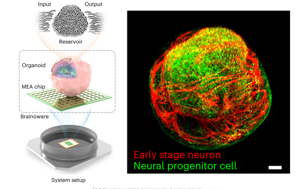 A close-up of a brain

Description automatically generated