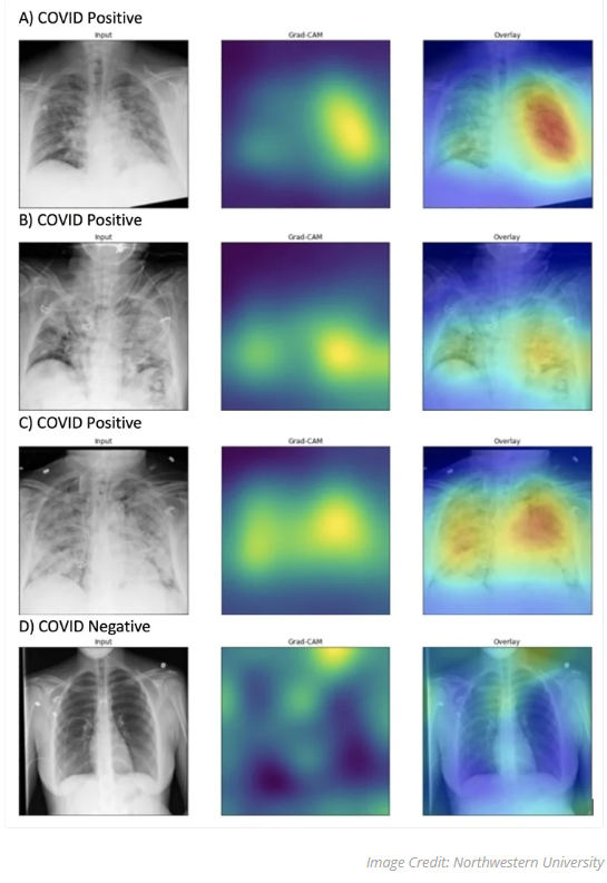 A collage of x-ray images

Description automatically generated